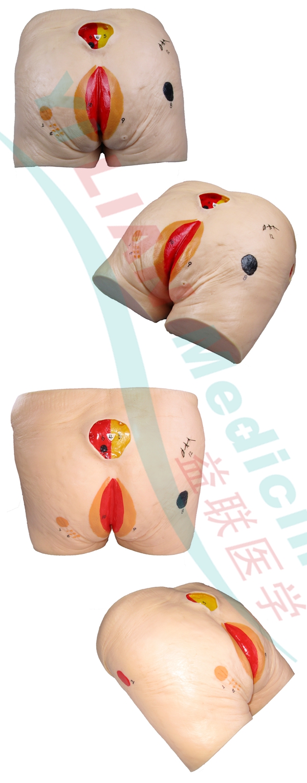 高級(jí)老年人褥瘡(壓瘡)護(hù)理模型